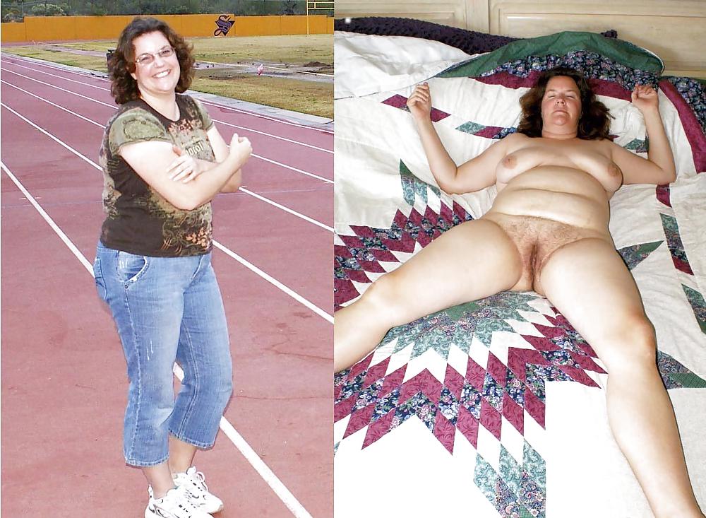 Before after 309. (Older women special). #3596518