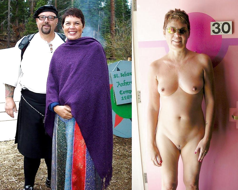Before after 309. (Older women special). #3596588