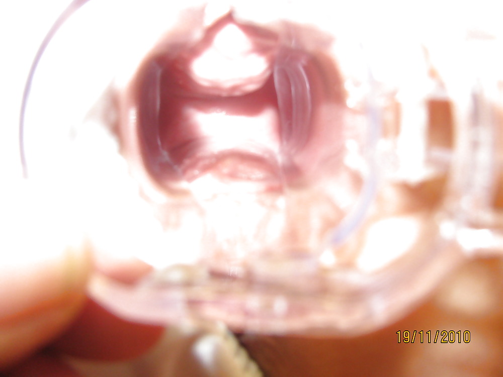 Whomen i Need help #1951859