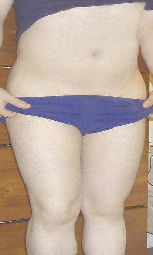 Front pic, MY HIPS  #8689987