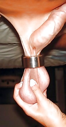 Cbt3 #20793515
