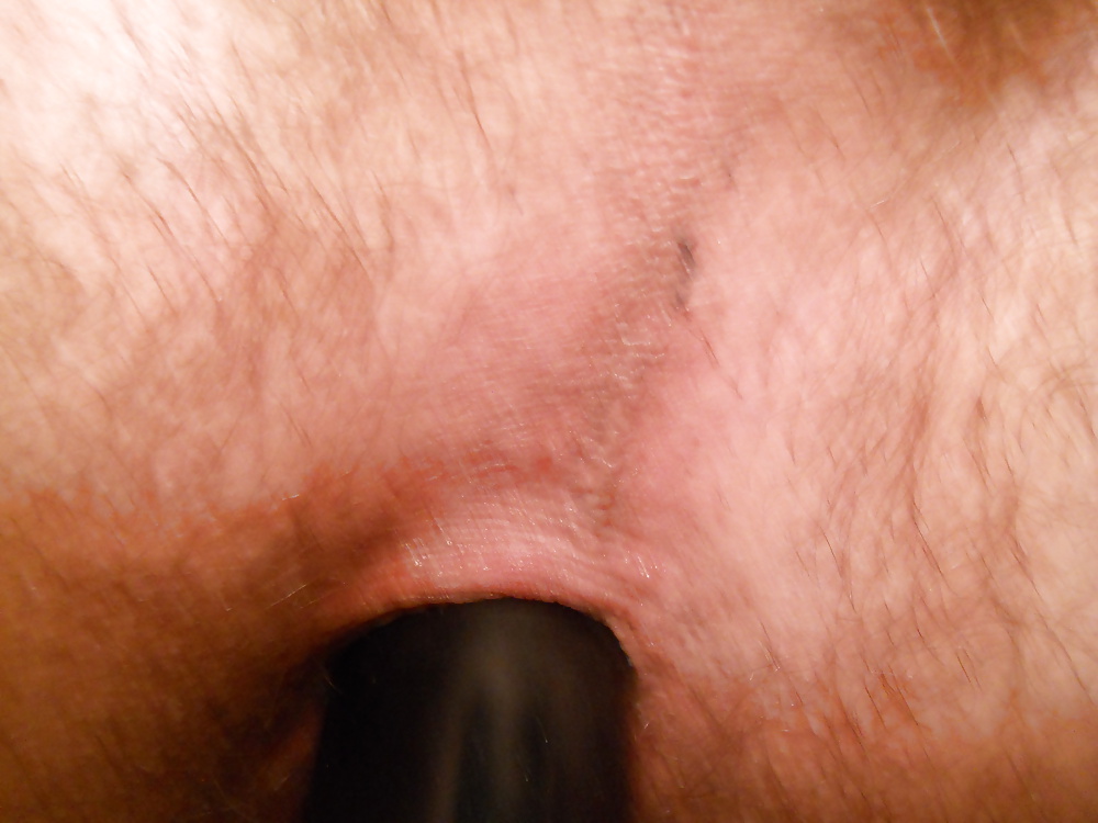 Mee #19308876