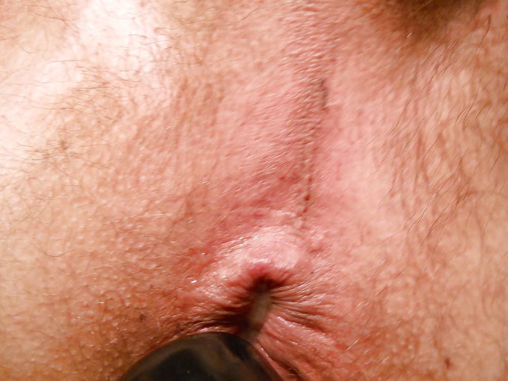 Mee #19308884