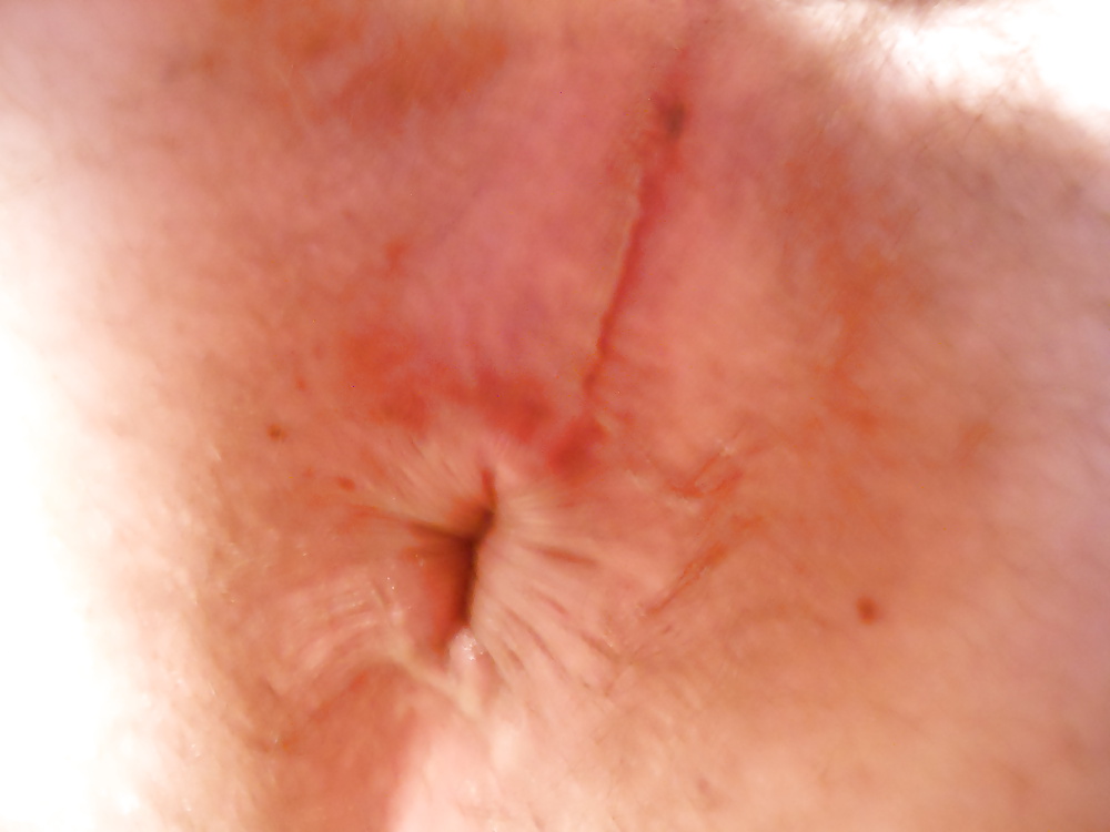 Mee #19308901