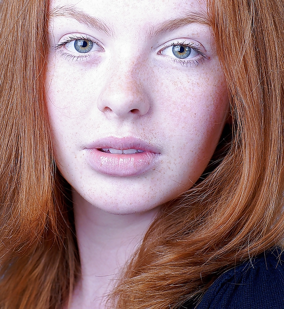 The Beauty Of Redheads & Freckles #11078986