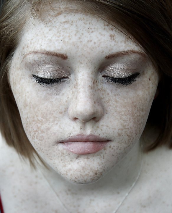 The Beauty Of Redheads & Freckles #11079016