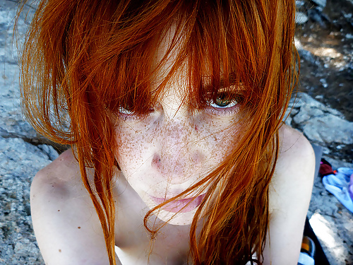 The Beauty Of Redheads & Freckles #11079051
