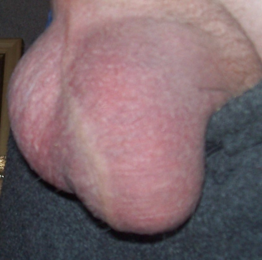 Dicke Eier