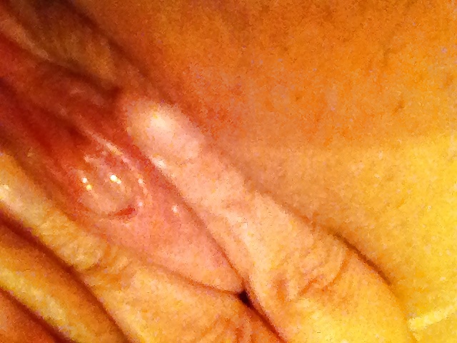 jouissif clito sur le vif
 #21202883