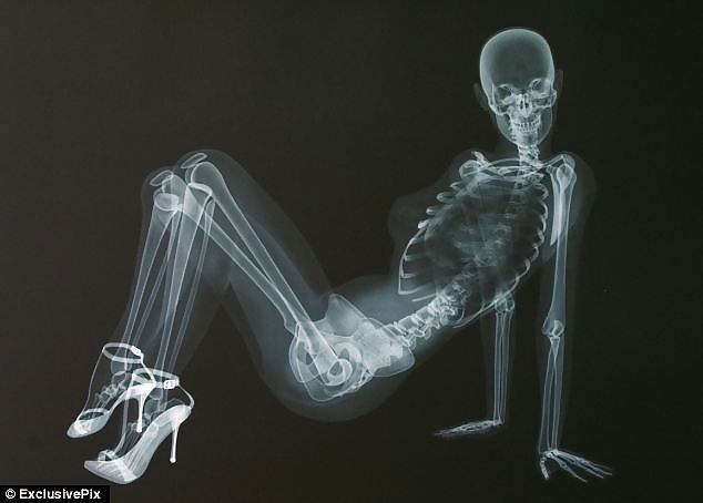 X-Ray in High Heels #21989160