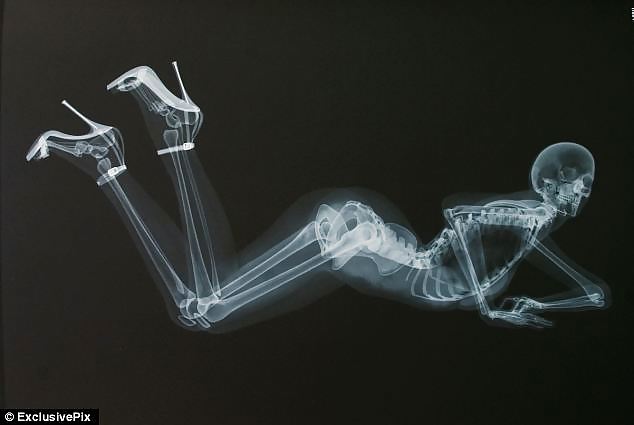 X-Ray in High Heels #21989165