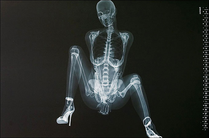 X-Ray in High Heels #21989167