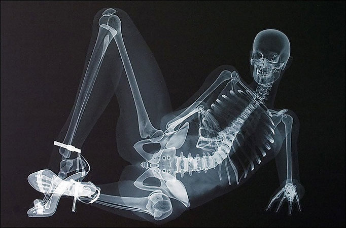 X-ray In High Heels #21989178