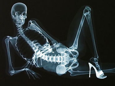 X-ray In High Heels #21989184