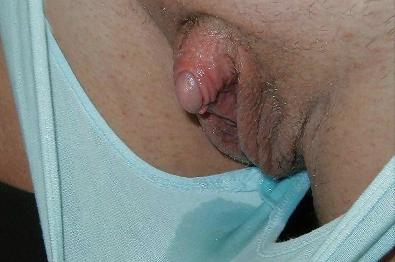 Huge Pussy Lips 9  #5492925