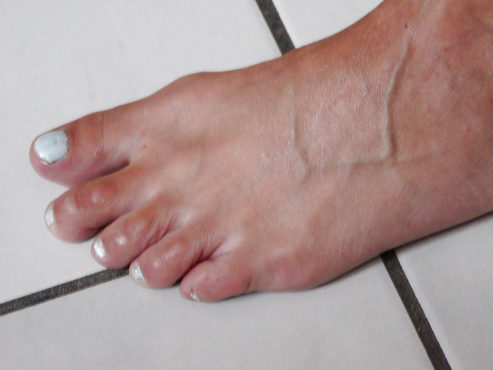 Mi fan silvy
 #5515422