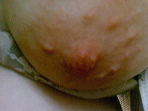 Yummy Nipples #4209699