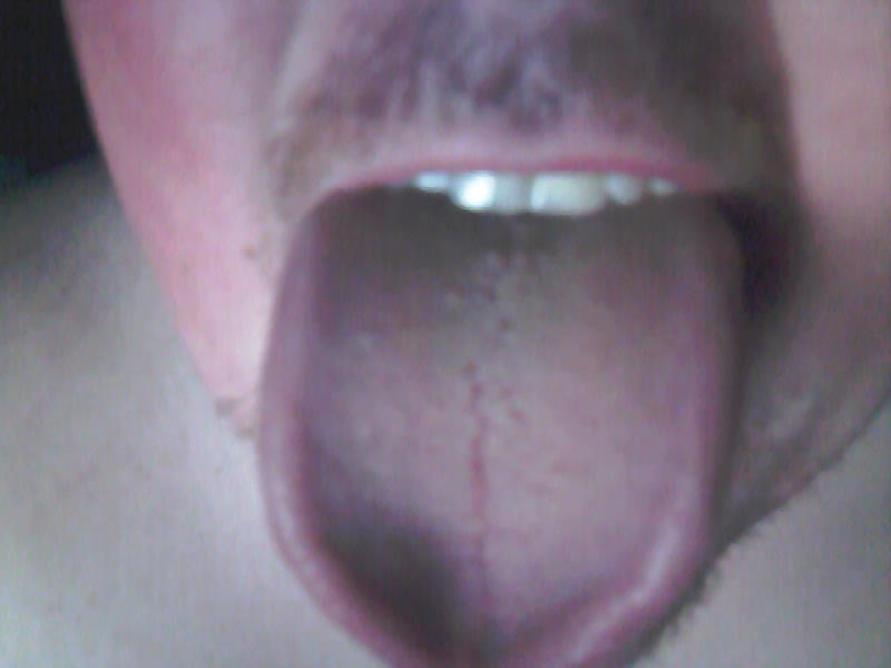 Tongue #1576130