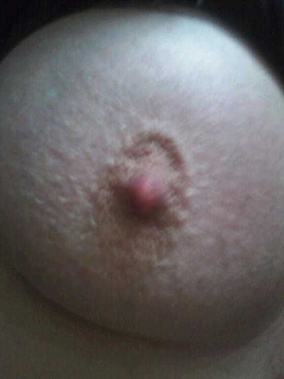 Mein Seiten Sprung  #14548450