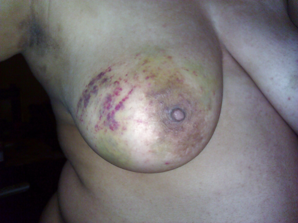 Nipples torture #13059372