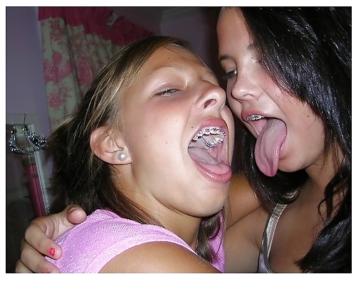 Sexy girls with braces #20119461