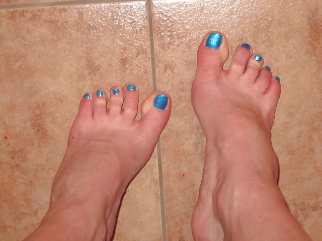 Uñas azules
 #9200063