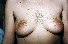 Hairy Nipple Pics