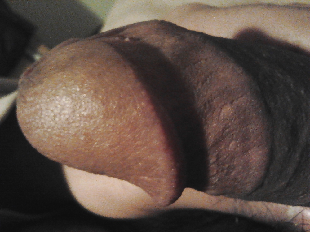 My Penis #7355261