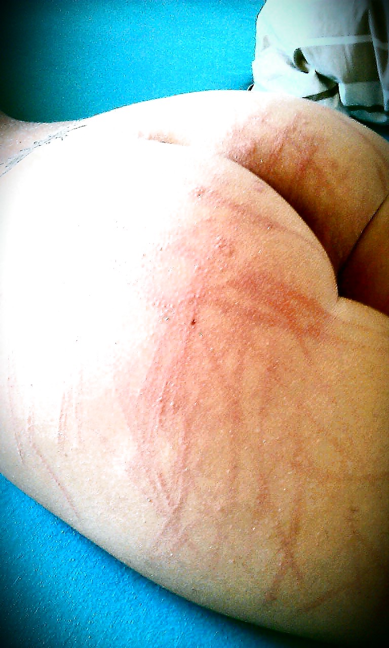 Spanking #18670246
