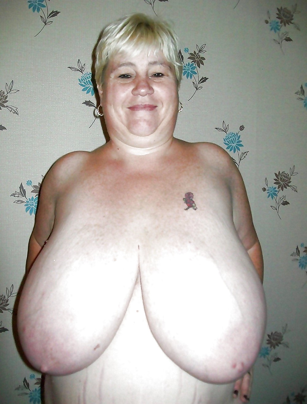 Stretch Marks, Scars and Saggy 15 #14043552