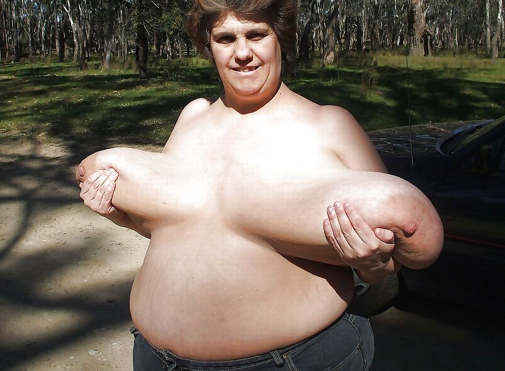 Stretch Marks, Scars and Saggy 15 #14043600
