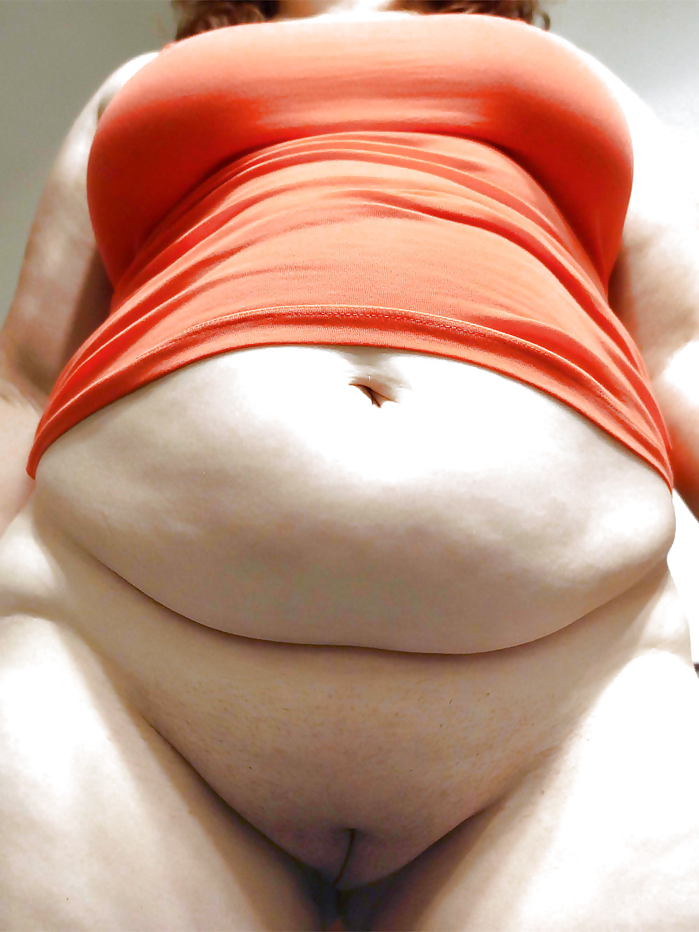 Stretch Marks, Scars and Saggy 15 #14043771