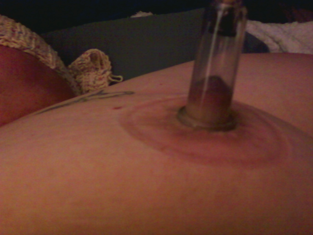 New cupping set #12155330