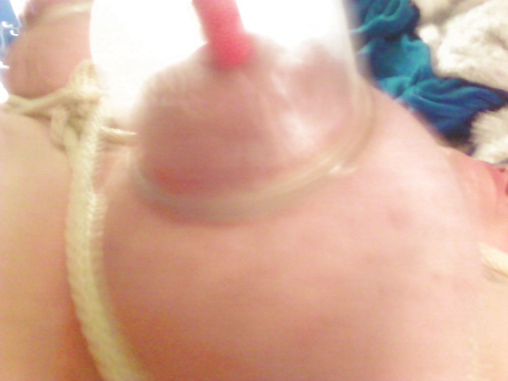 New cupping set #12155337