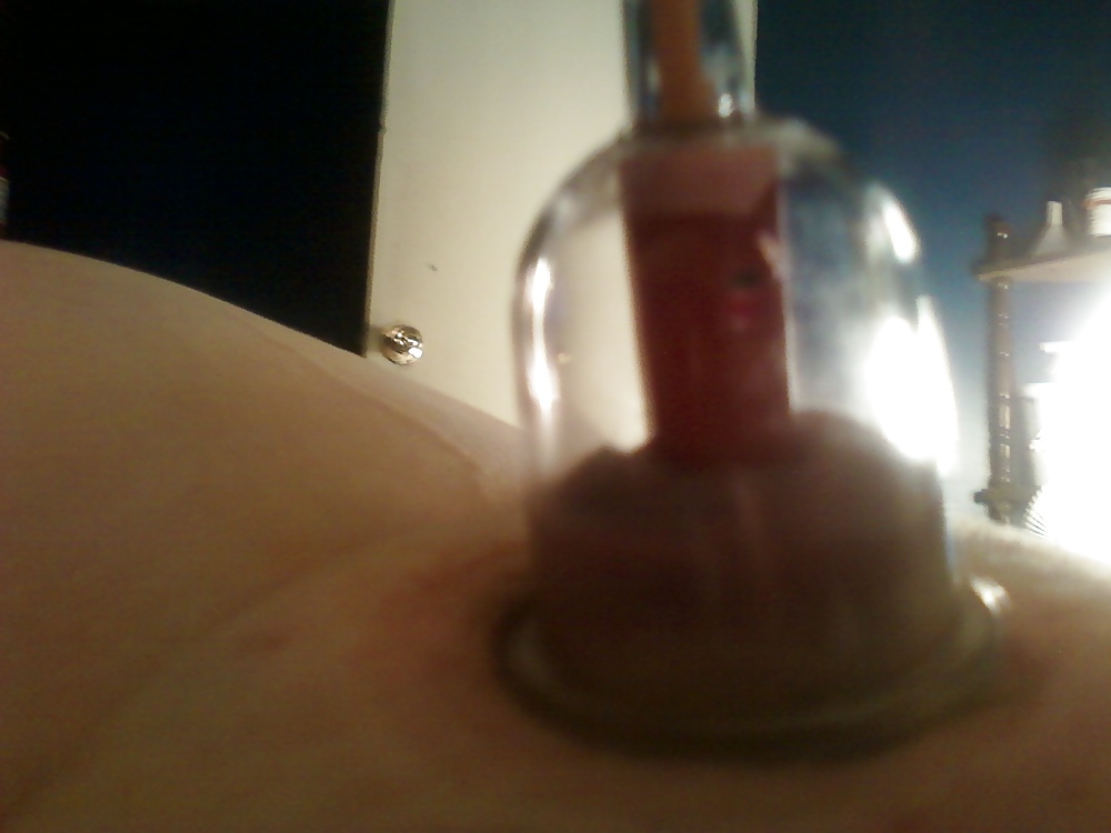 New cupping set #12155342