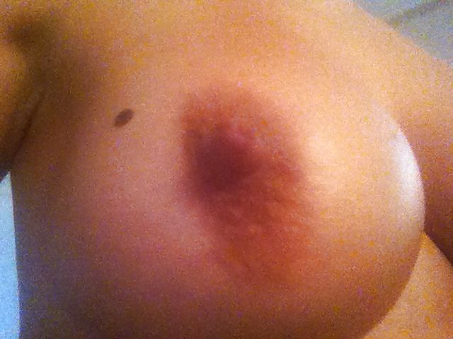 Caliente húngaro
 #20567286