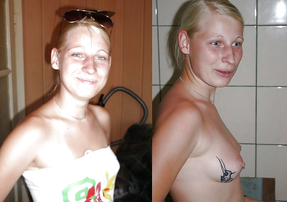 Before and After 5 #4954770