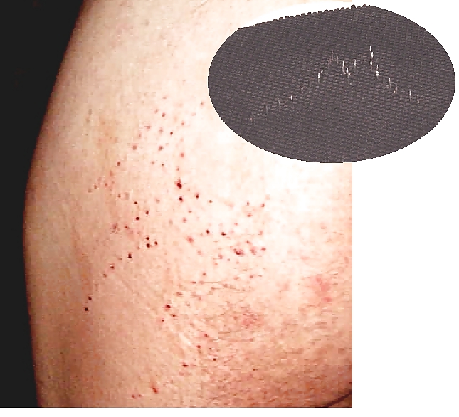 Prügel Neddle Ms In Den Arsch #15088876