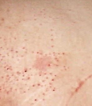 Prügel Neddle Ms In Den Arsch #15088895