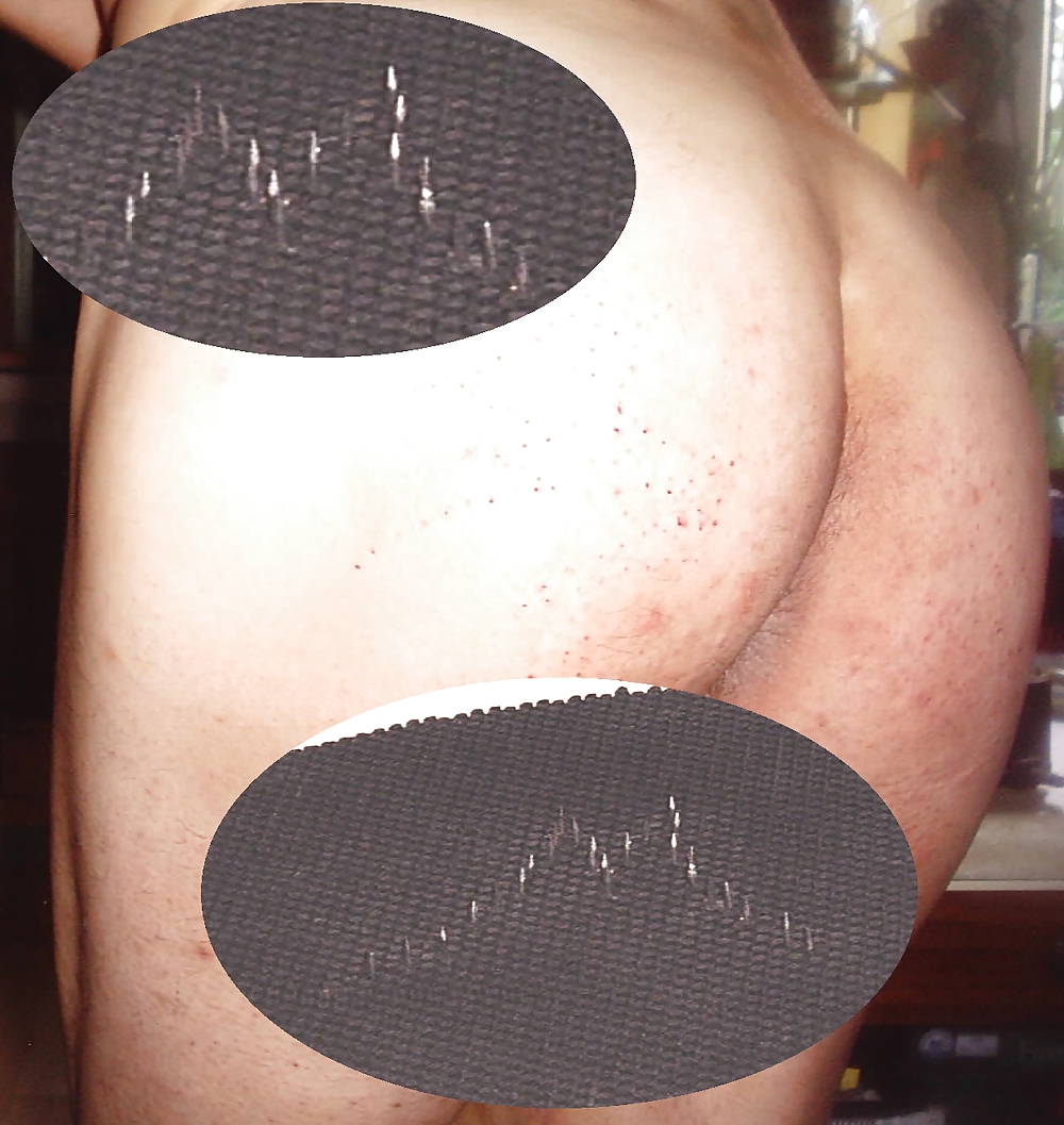 Prügel Neddle Ms In Den Arsch #15088904