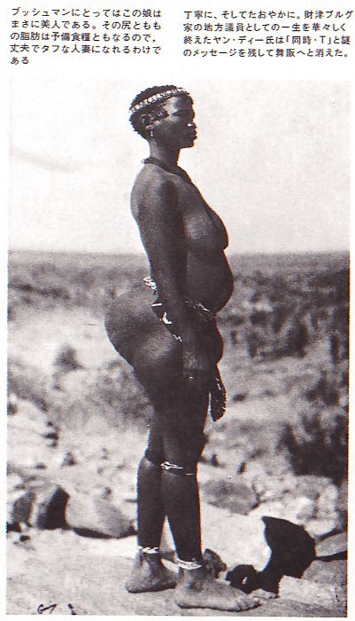 STEATOPYHGIA #21889674