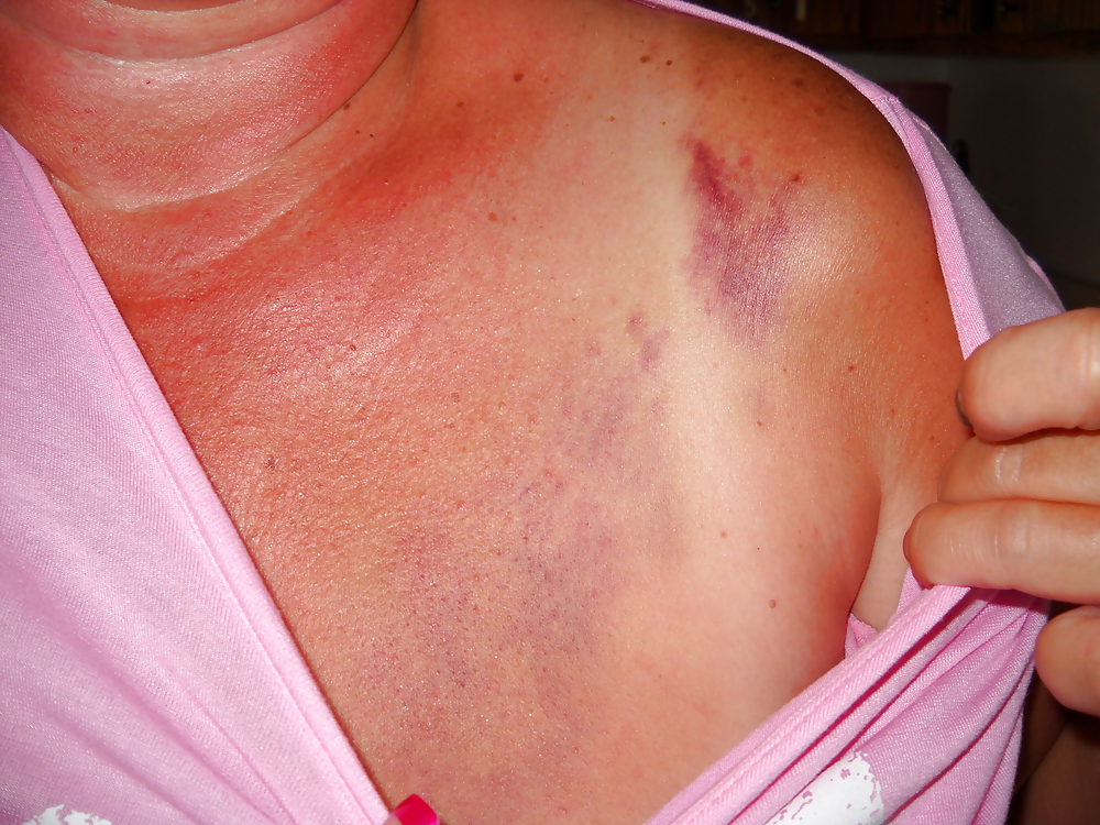 Fotos favoritas
 #11678932