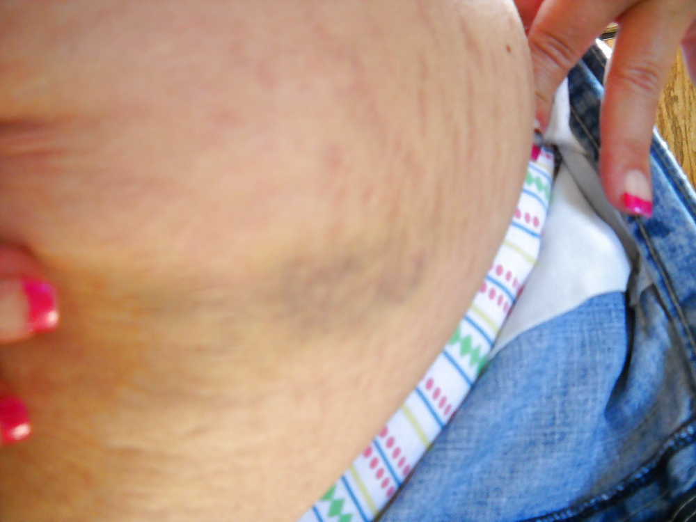 Fotos favoritas
 #11678941