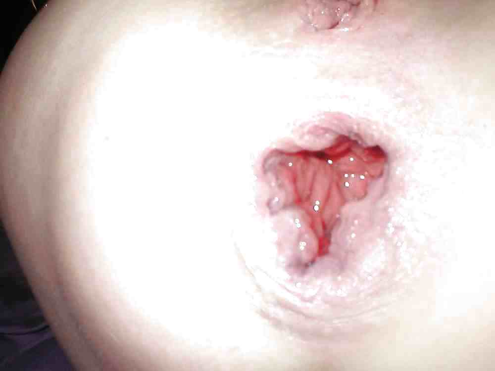 Dirty ass gape #10958901