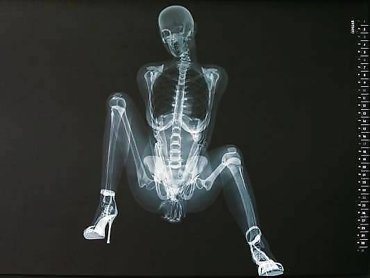 Patrick68 - Gefunden In Web #2080234