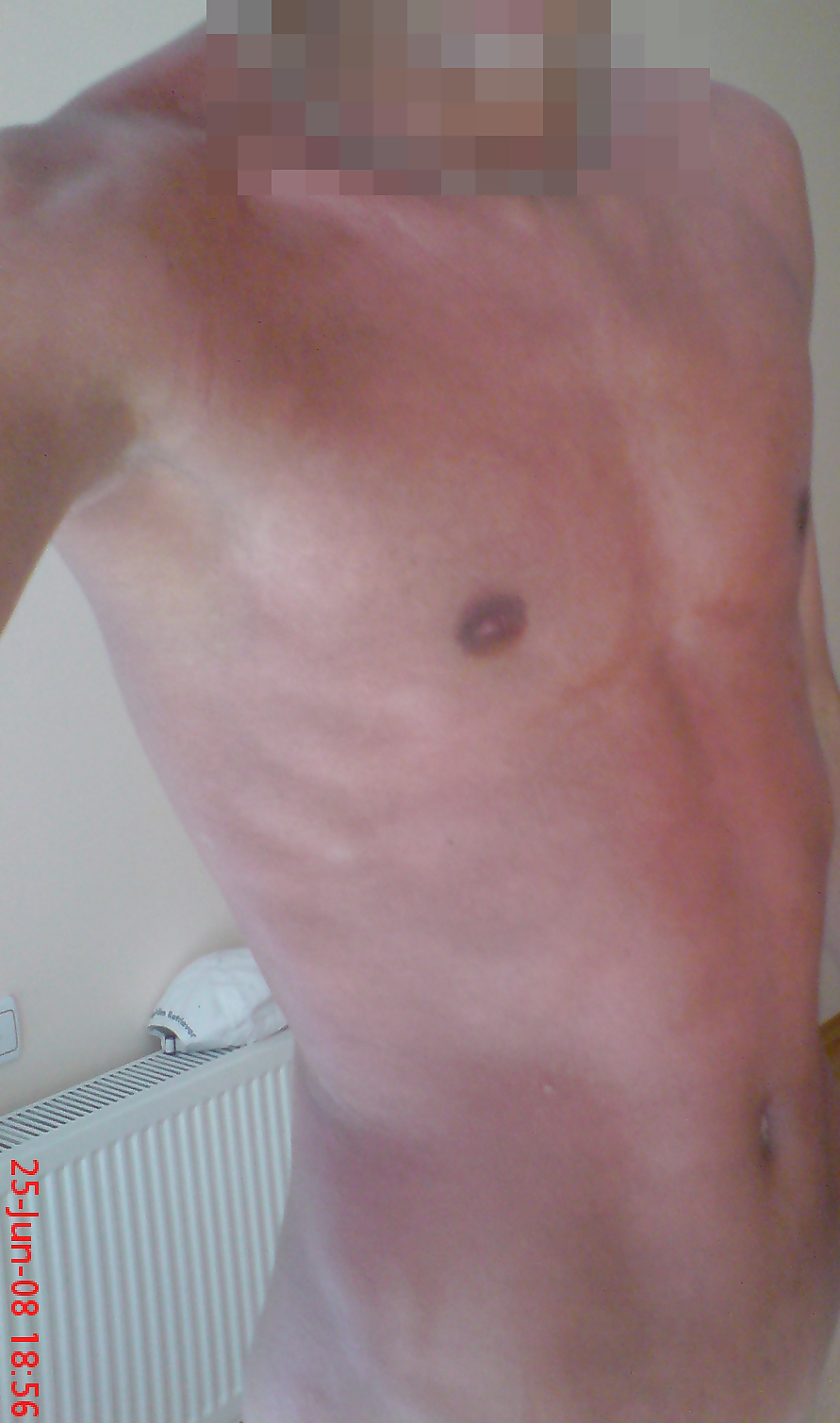 My Body #3606486