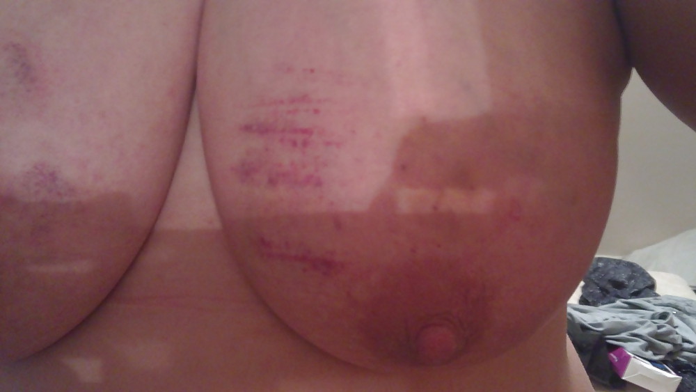 Scottish slut tit torture #4426980