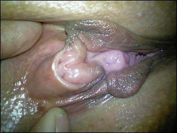 Ist Meine Klitoris Geschwollen ???? #2327502