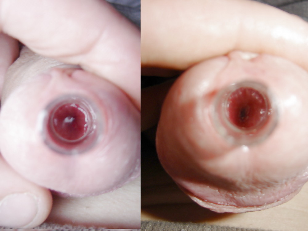 Bdsm inserzioni estreme uretrale anale femdom
 #1060630