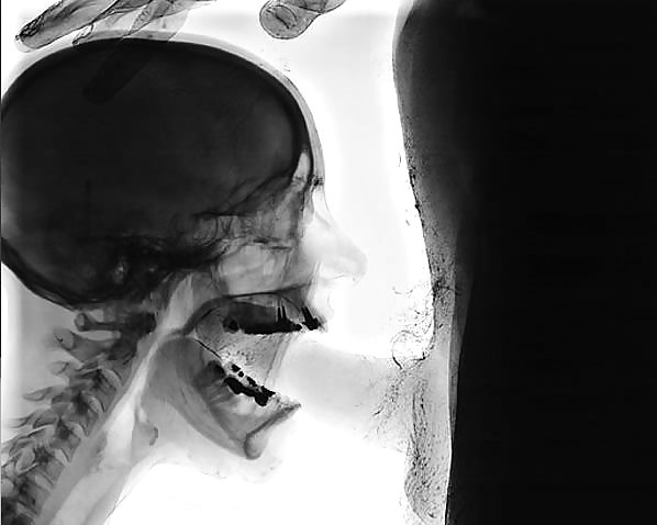 X-Ray Erotica #10024242